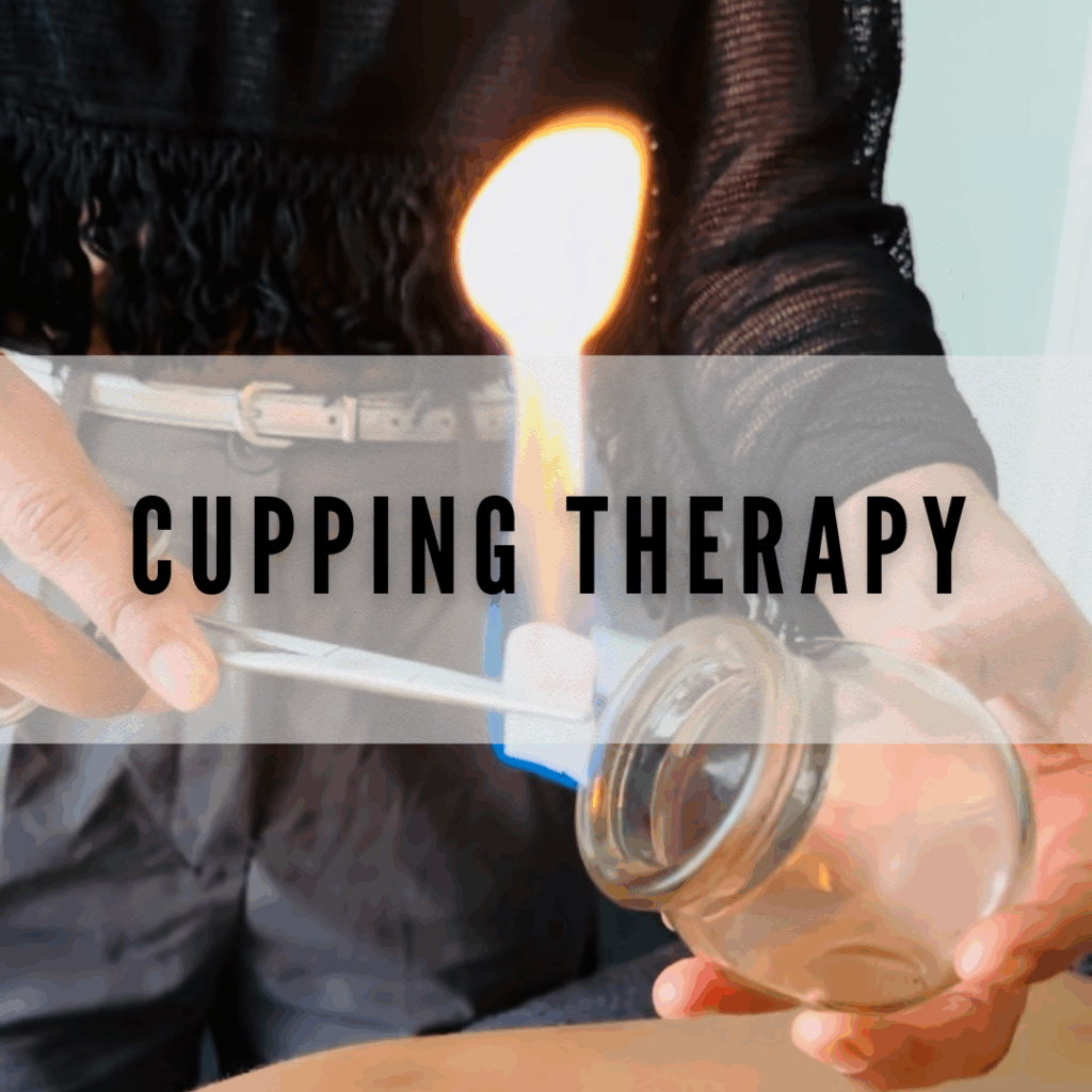 Cupping Therapy Leeds