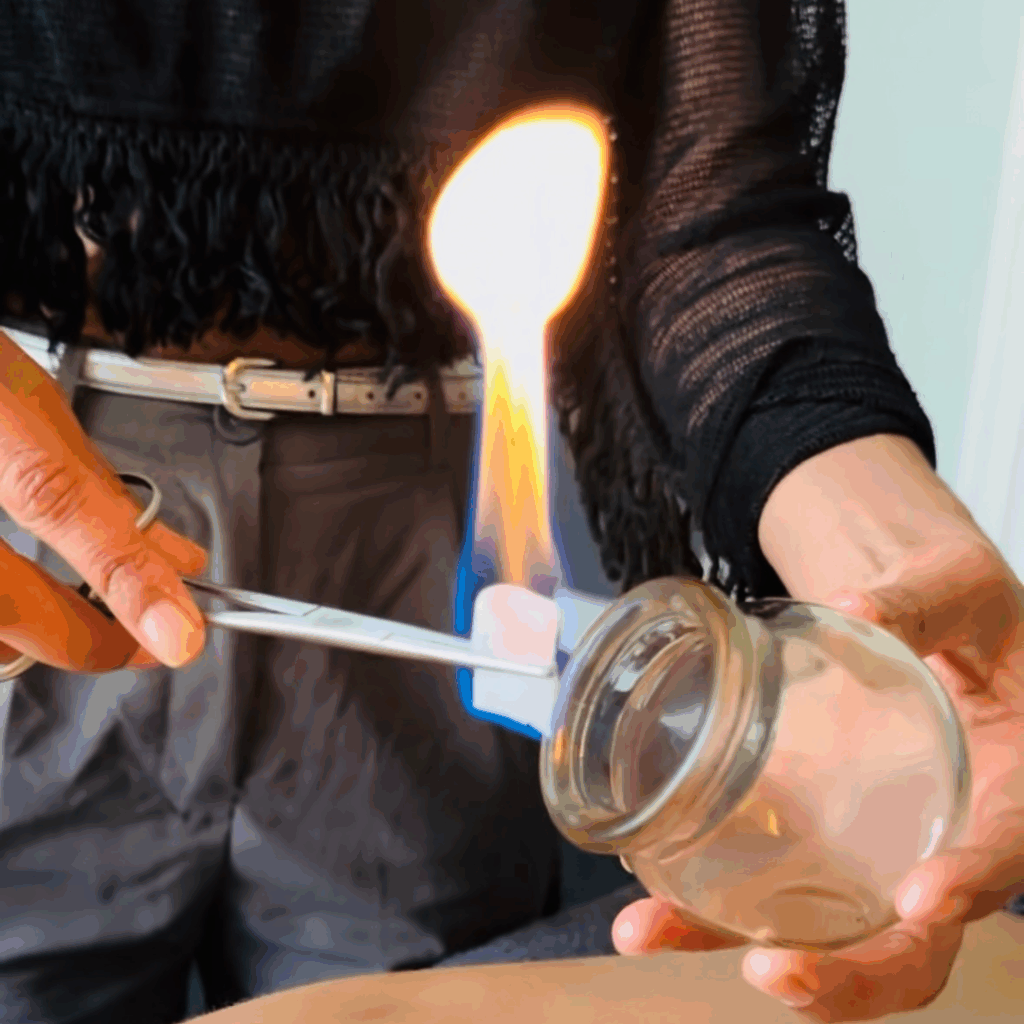 Cupping Therapy Leeds